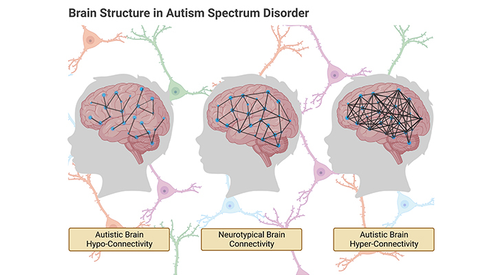 brain structure in autism spectrum disorder