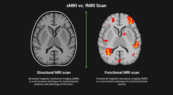 sMRI vs fMRI Scan