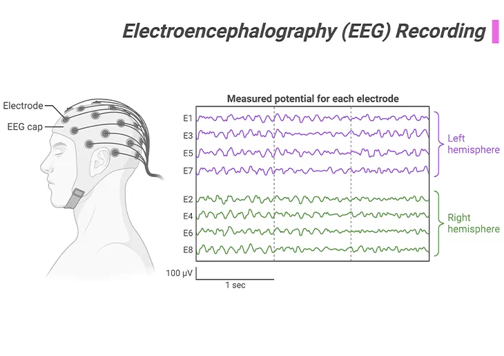 Electroencehalography (EEG) Recording
