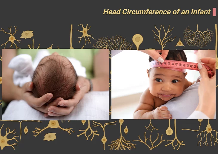 Head Circumference of an Infant