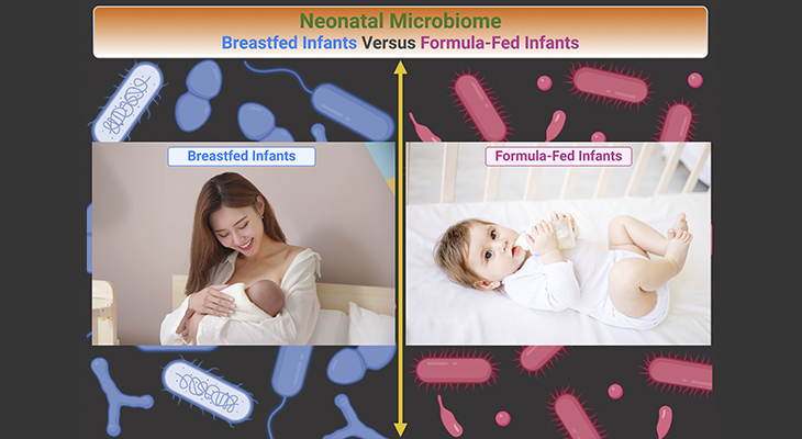 Neonatal Microbiome Breastfed Infants Versus Formula Fed Infants