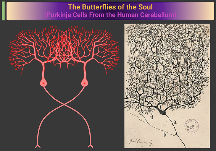 The Butterflies of the Soul (Purkinje Cells from the Human Cerebellum)