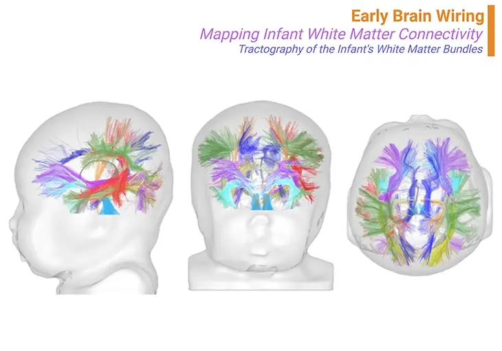 Early Brain Wiring - Mapping Infant White Matter Connectivity