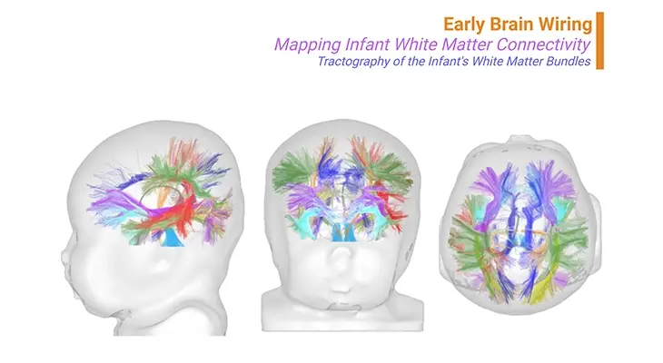 Brain Plasticity – III: Fueling Brain Growth – The Vital Role of Nutrition During Sensitive Periods of Learning