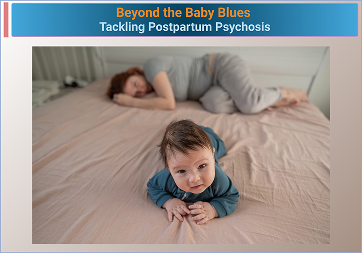 Beyond the Baby Blues – Tackling Postpartum Psychosis